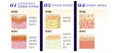 呼市緊膚除皺用什么方法見效快