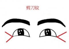 呼和浩特整形醫(yī)院祛除魚尾紋的方法有哪些?