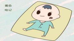 呼和浩特整形醫(yī)院治療胎記激光好還是皮秒好?