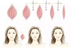 注射瘦臉針后有哪些注意事項(xiàng)?