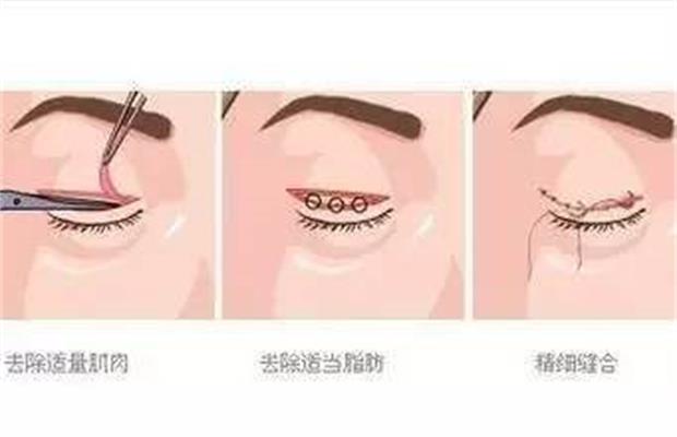pƤޏ(f)g(sh)X(qin)