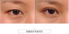 ͺظpƤX(qin)?