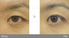ͺpƤ_(ki)۽ǶX(qin)?