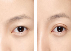 ۲´CҪX(qin)?
