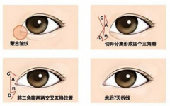 _(ki)۽g(sh)(hu)Ӱ푺zY