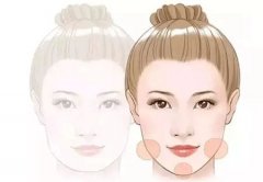 哪些方法可以去除眉間紋?