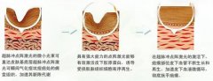 ӡ(hu)(hu)