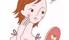 呼市激光祛痘事項(xiàng)與護(hù)理有哪些?