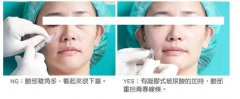 呼市整容注射多了會有什么反應(yīng)呢?