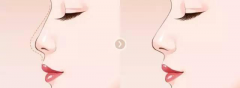 ͺg(sh)ʽһĎ׷N