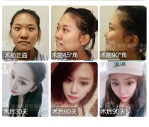 你還不注意晚間護(hù)膚工作嗎?呼市整形一樣