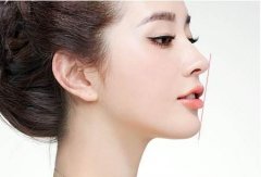 隆鼻手術(shù)恢復(fù)時間方法有哪些